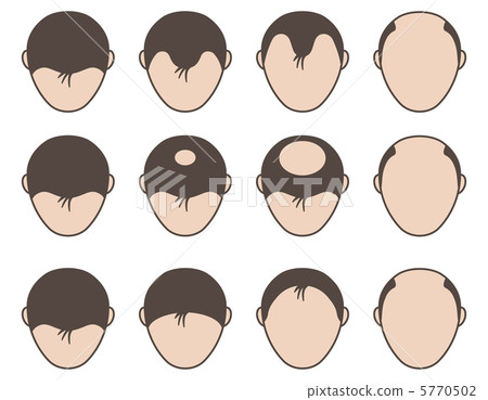 脫毛 -  25 5770502