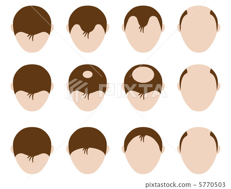 脫毛 - 26 脫毛 - 26 5770503