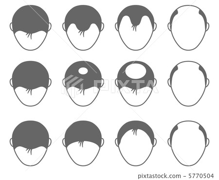 脫毛 -  27 5770504