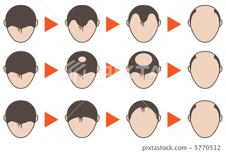 脫毛 -  32 5770512