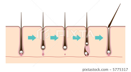 Hair cycle - 2 5775317