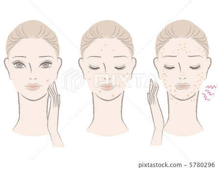 痤瘡瑕疵皮膚麻煩皮膚麻煩例證婦女 5780296
