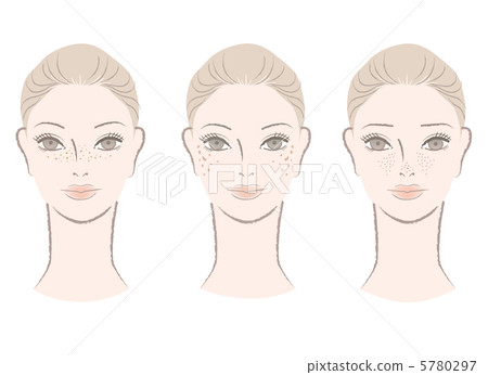 毛孔開放斑點雀斑祛斑肝臟變黑皮膚麻煩插圖女性 毛孔開放斑點雀斑祛斑肝臟變黑皮膚麻煩插圖女性 5780297