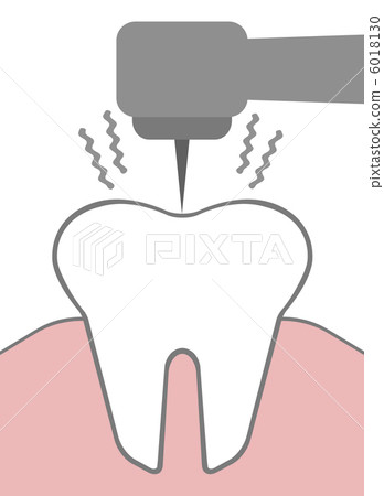牙科治療 6018130