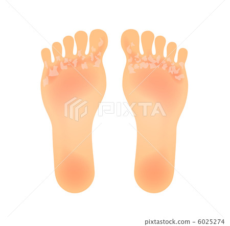 Skin-popping sole of the foot Skin-popping sole of the foot 6025274