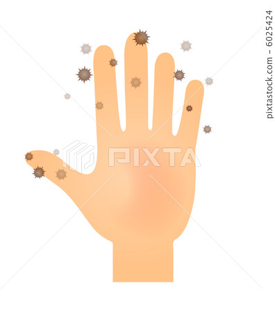 附有病毒的棕櫚 6025424