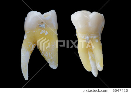 Maxillary molar 6047410