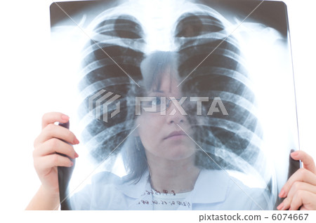 Doctor looking at x-ray 6074667