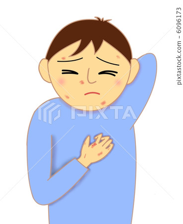 過敏發癢的男孩 6096173