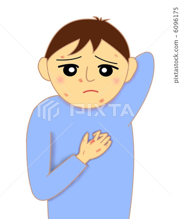 過敏發癢的男孩 6096175