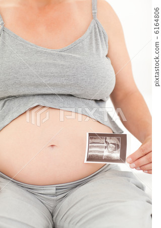 Pregnant woman with her X-ray Pregnant woman with her X-ray 6164806
