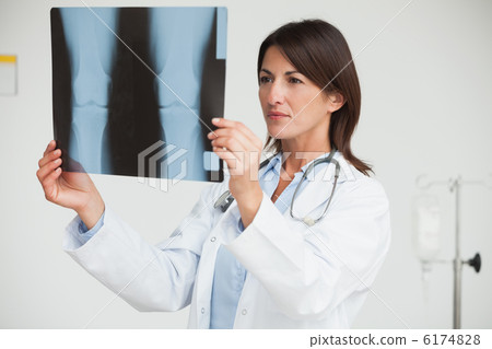 Doctor analysing x-ray 6174828