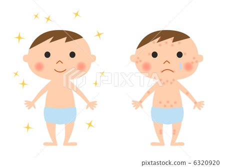 Child and atopy - Stock Illustration [6320920] - PIXTA