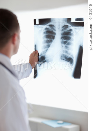 Close up of doctor holding x-ray against light 6431946
