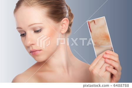 concept skincare . Skin beauty  woman with redness 6488788