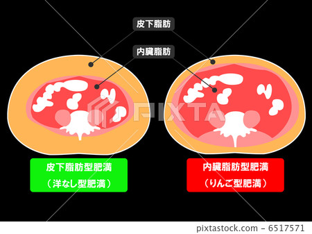 內臟脂肪和皮下脂肪的剖面圖 6517571