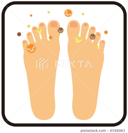 Athlete foot (instep of the foot) A-1 6598963