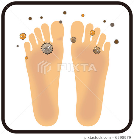 Athlete's foot (soles of feet) A-7 6598979