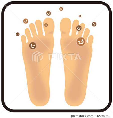Athlete's foot (soles of feet) A-10 6598982