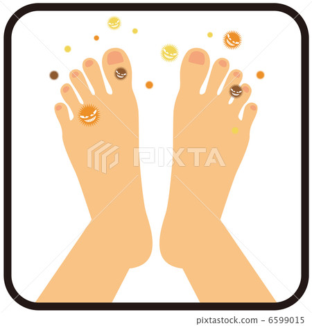 Athlete foot (instep) B - 1 Athlete foot (instep) B - 1 6599015