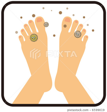 Athlete foot (instep of the foot) B - 5 6599019