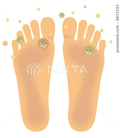 Athlete foot foot (Bottom foot) B-4 6655583