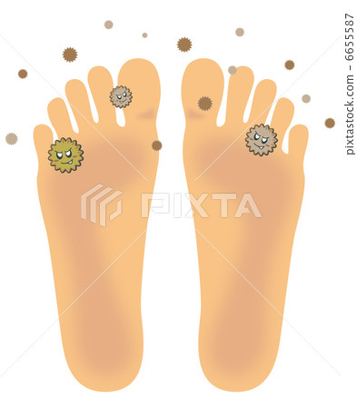 Athlete foot foot (Bottom foot) B - 5 6655587