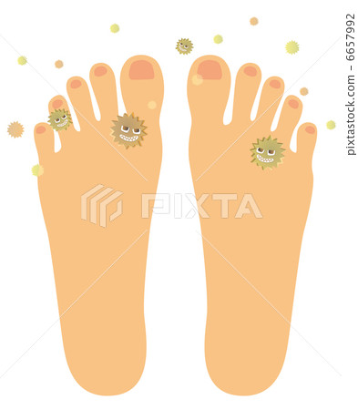 Athlete foot (instep) C - 4 6657992