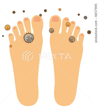 運動員腳（腳背）C  -  7 6657995