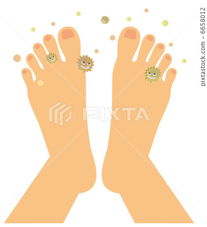 Athlete's foot (instep of the foot) D-4 6658012