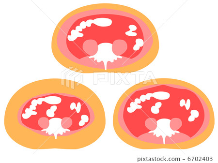 內臟脂肪和皮下脂肪的剖面圖 6702403