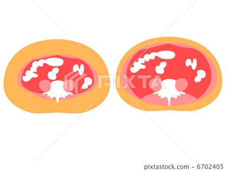 Sectional view of visceral fat and subcutaneous fat Sectional view of visceral fat and subcutaneous fat 6702405