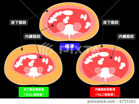 內臟脂肪和皮下脂肪的剖面圖 6755261