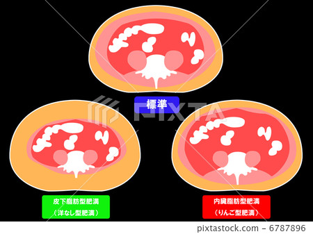 Sectional view of visceral fat and subcutaneous fat 6787896