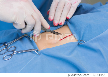 Surgeon incising a patient stomach Surgeon incising a patient stomach 6923455