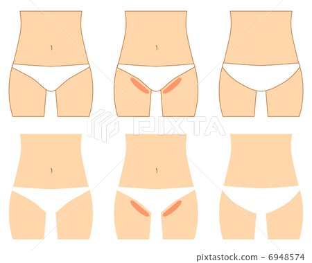 V line V line 6948574