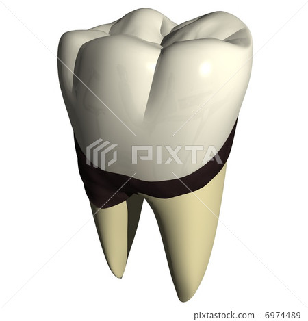 牙齒有微積分 6974489