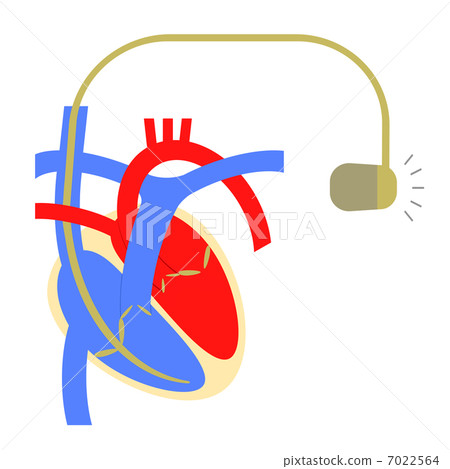 Cardiac pacemaker 7022564