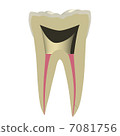 Tooth rooted 7081756