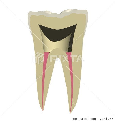Tooth rooted 7081756