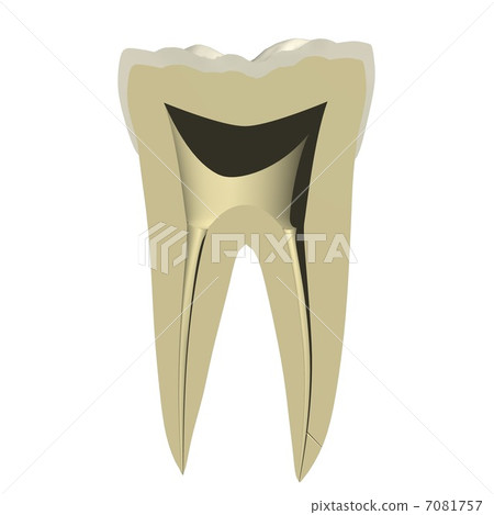 Cutting face of tooth 7081757