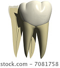 Cutting and misaligned teeth 7081758
