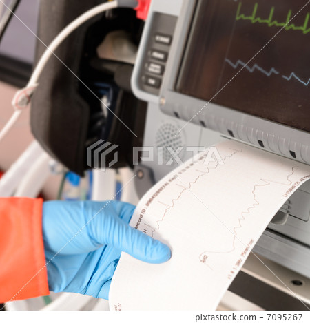 Cardiac monitor printing ekg results monitor pulse 7095267