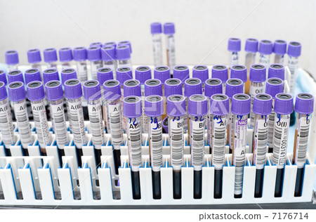 test tubes with donor blood 7176714
