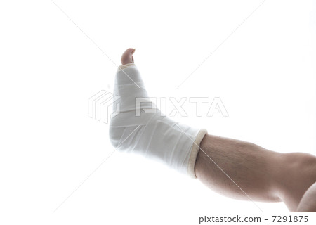 Fracture Gibbs right foot 7291875