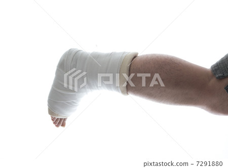 Fracture Gibbs right foot 7291880