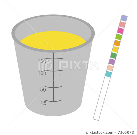 尿液分析 7305078