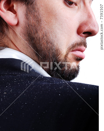 Dandruff issue on mans sholder 7391507