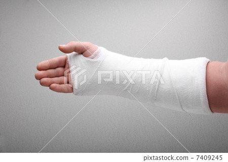 broken arm bone in cast 7409245