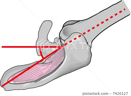 rehabilitation, injury, disection 7420127